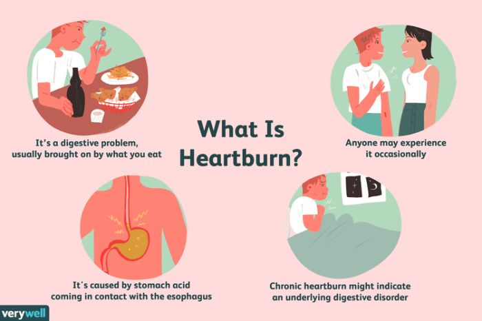 Reflux acid remedies heartburn pain relieve natural treatment food dressings onions salads avoid tomatoes meal cheese primary fat those high