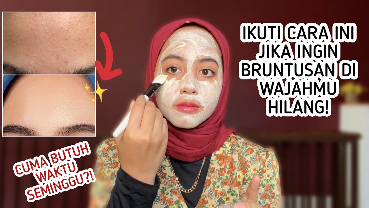 Rahasia Hilangkan Bruntusan Membandel Kulit Mulus Bebas Jerawat!